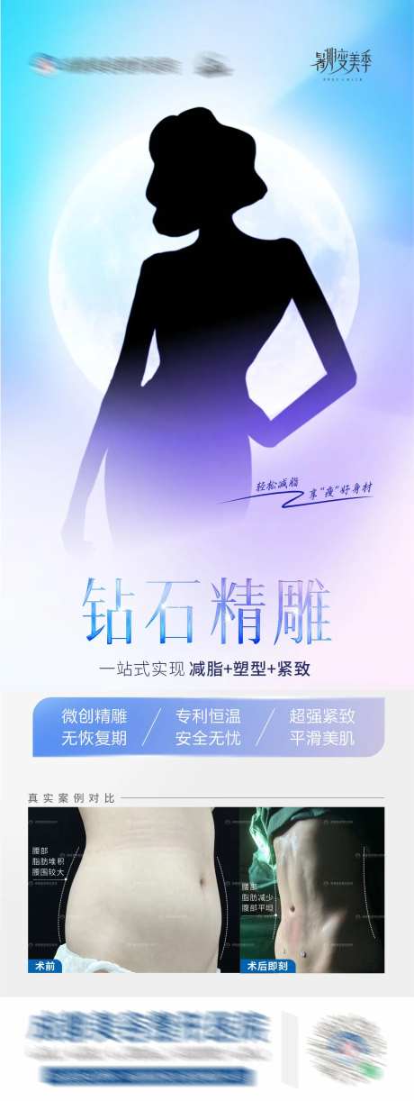 钻石精雕腰腹吸脂案例海报-采灵感-https://www.cailinggan.com/