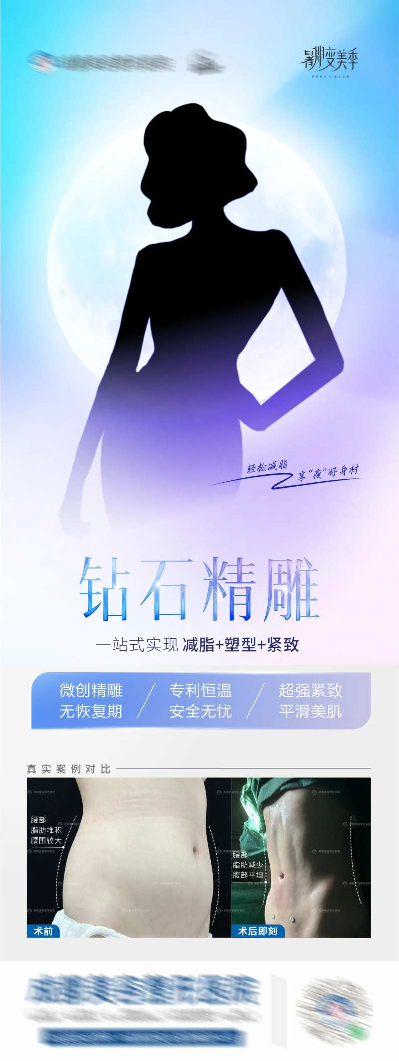 钻石精雕腰腹吸脂案例海报-采灵感-cailinggan.com