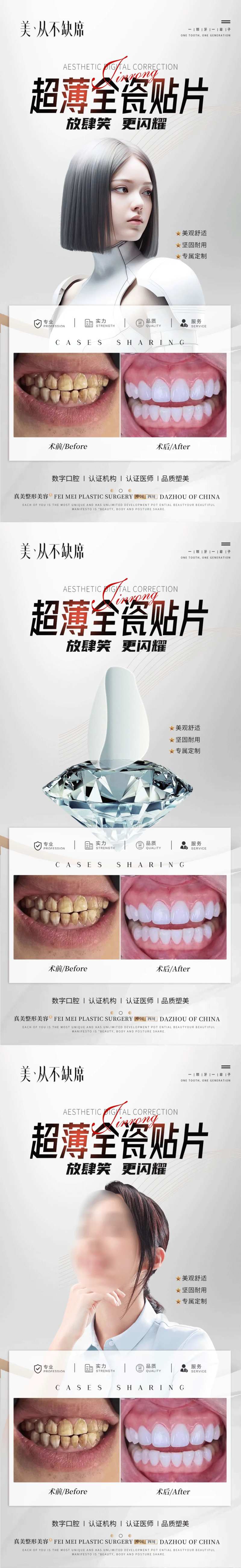 全瓷贴片案例海报-采灵感-cailinggan.com