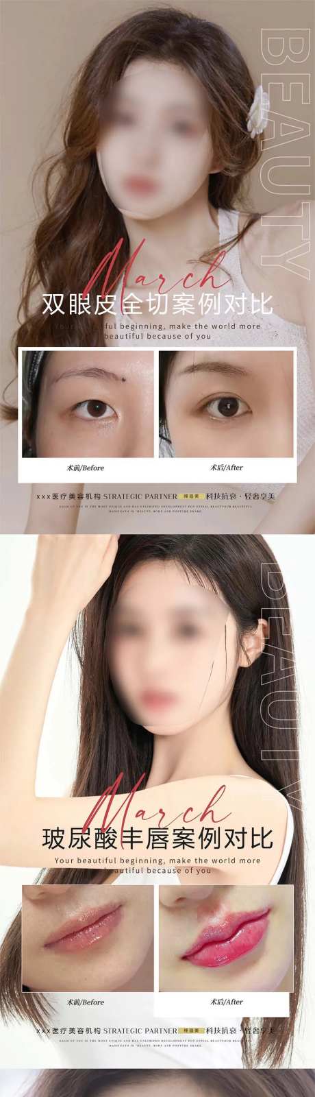医美案例对比图海报-采灵感-https://www.cailinggan.com/