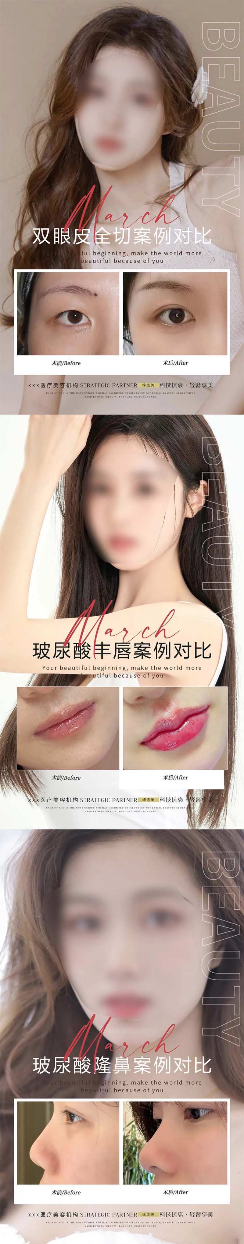 医美案例对比图海报-采灵感-cailinggan.com