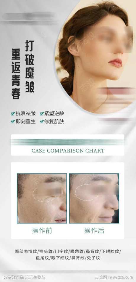 打破魔皱重返青春案例对比-采灵感-https://www.cailinggan.com/