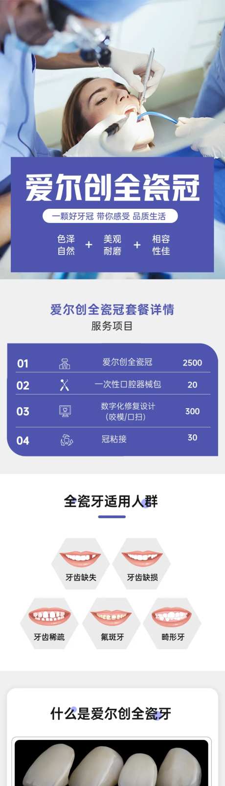 爱尔创全瓷牙冠详情页-采灵感-https://www.cailinggan.com/