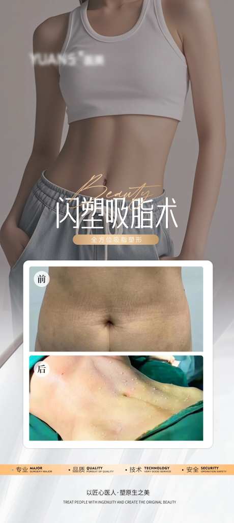 吸脂瘦腰案例-采灵感-https://www.cailinggan.com/