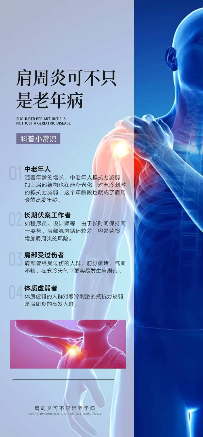 肩周炎常识知识小百科-采灵感-cailinggan.com