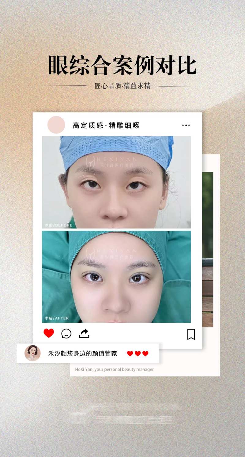 医美眼综合案例海报-采灵感-cailinggan.com