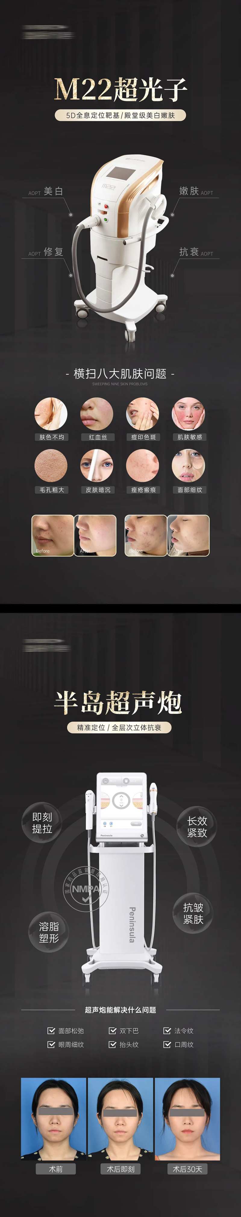 M22光子嫩肤超声炮易拉宝展架-采灵感-cailinggan.com