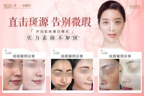 整形美容祛斑海报-采灵感-https://www.cailinggan.com/
