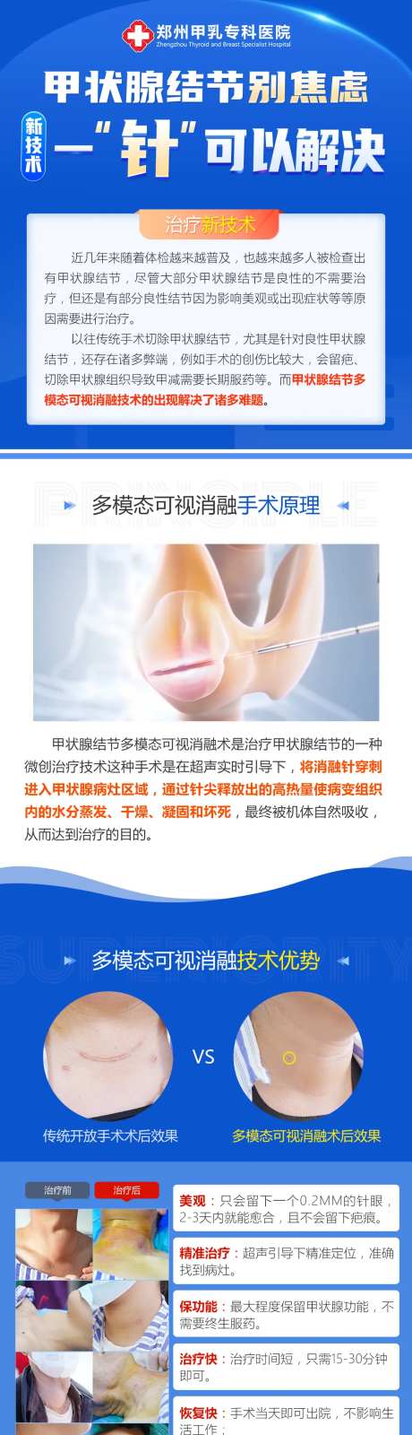 甲状腺结节海报-采灵感-https://www.cailinggan.com/
