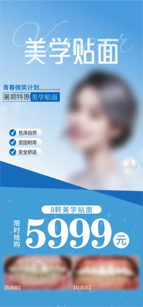 美学贴面-采灵感-https://www.cailinggan.com/