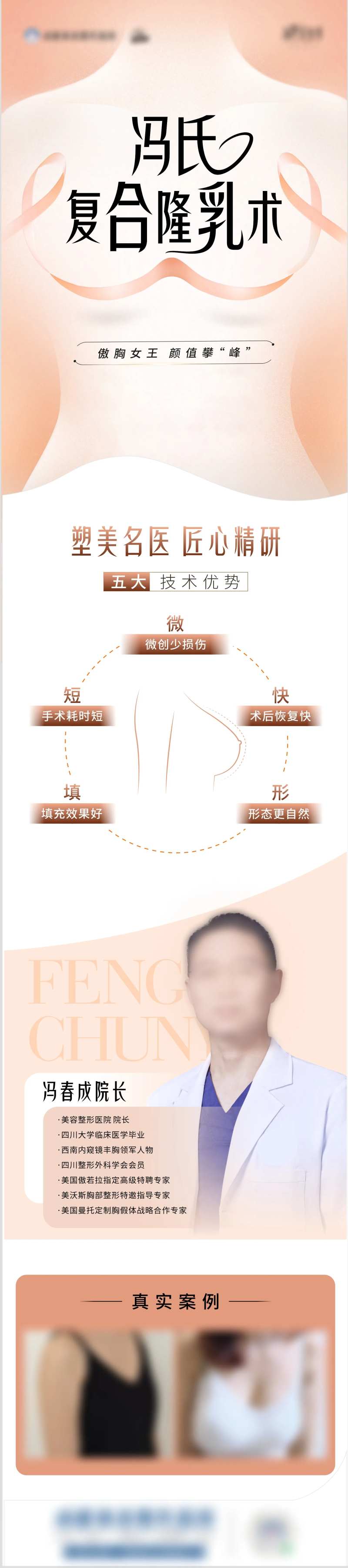 隆胸-采灵感-cailinggan.com