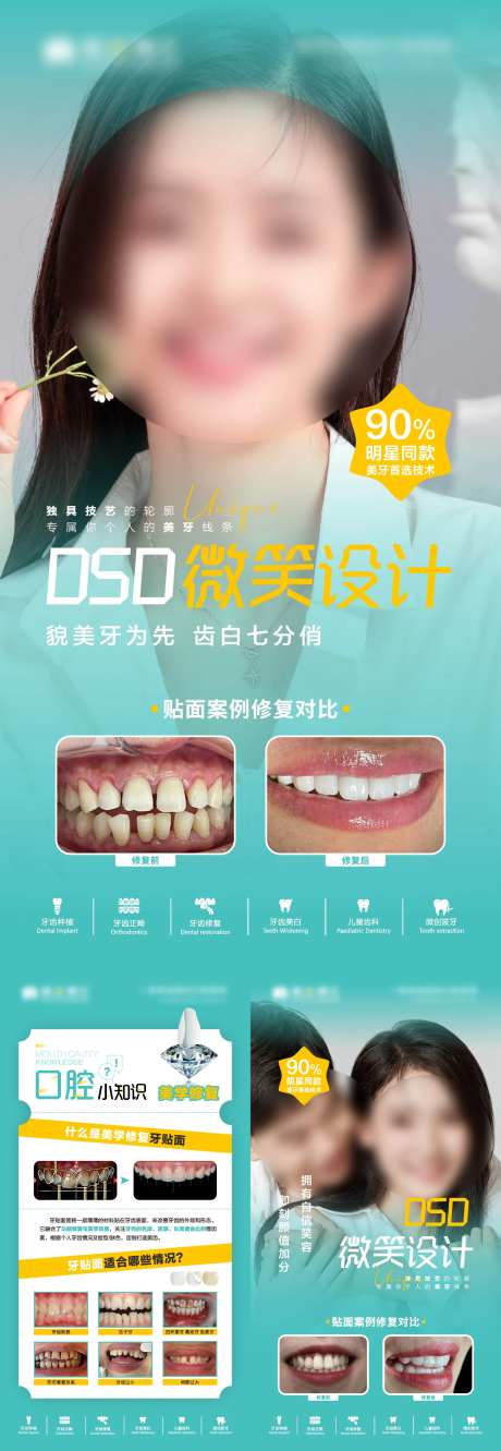 牙贴面美牙口腔长图海报-采灵感-https://www.cailinggan.com/