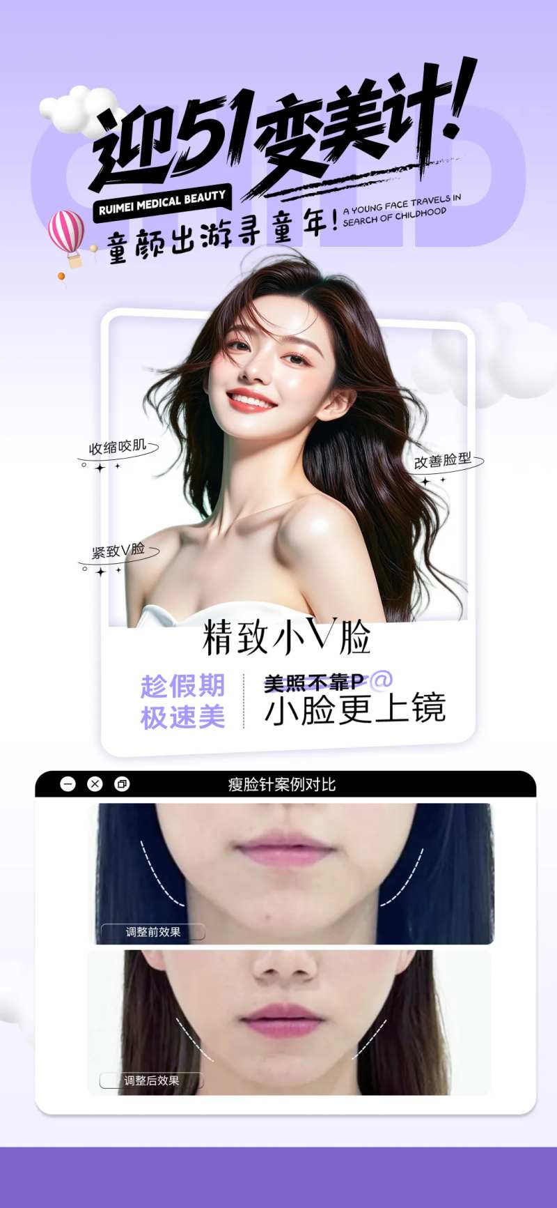 瘦脸针案例宣传海报-采灵感-cailinggan.com