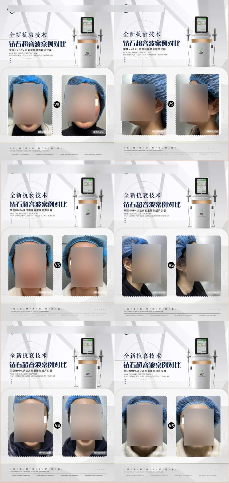 钻石超音波仪器案例对比海报-采灵感-cailinggan.com