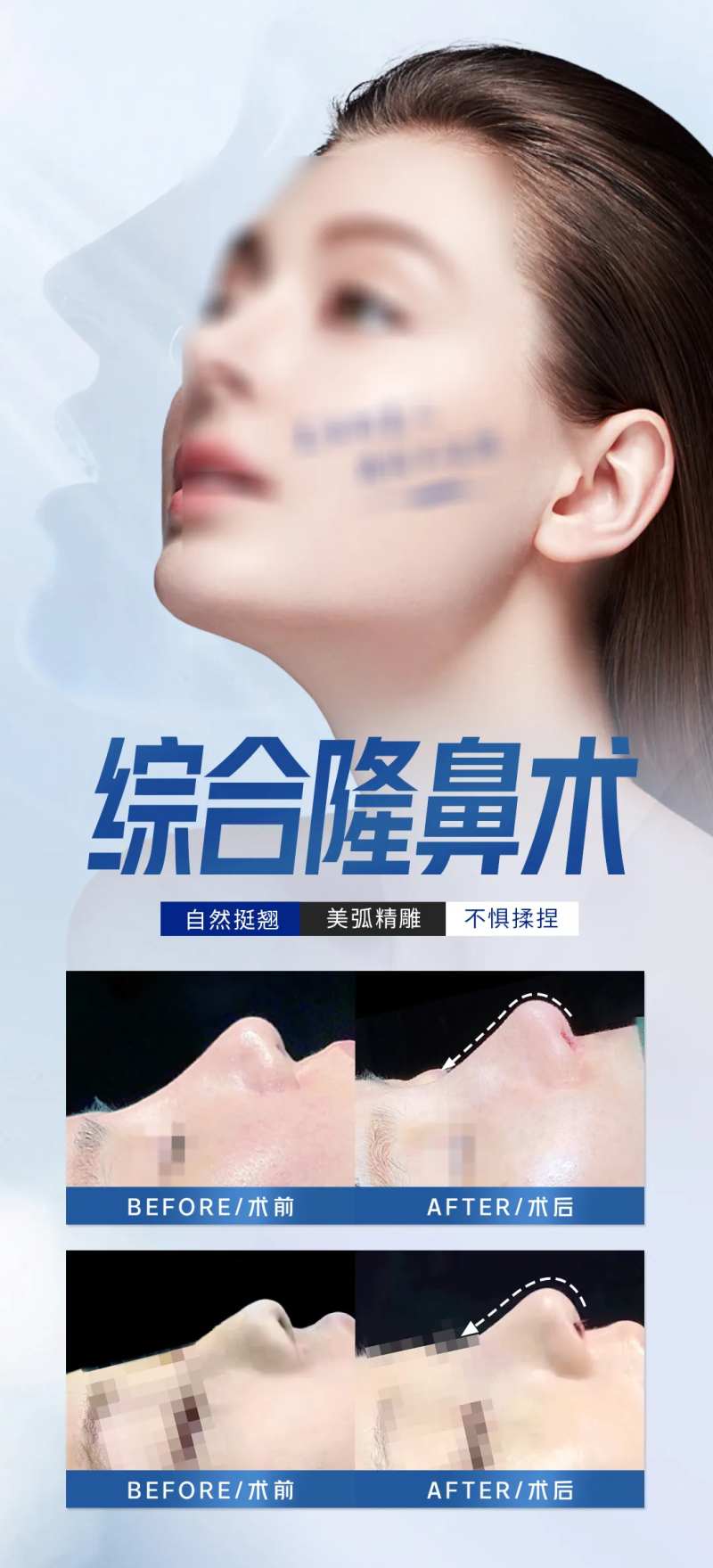 医美整形项目-采灵感-cailinggan.com