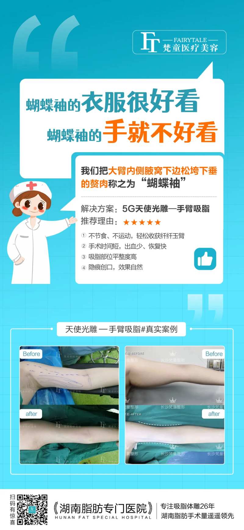 蝴蝶袖手臂吸脂案例海报-采灵感-cailinggan.com