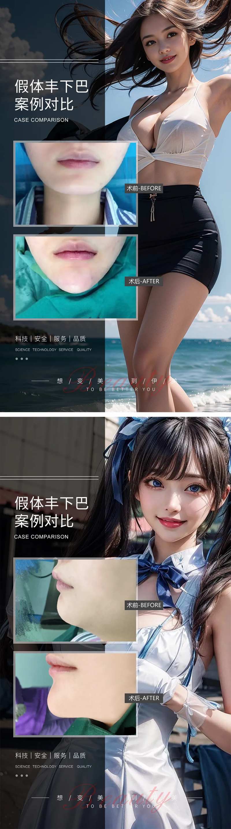 假体丰下巴案例对比系列海报-采灵感-cailinggan.com