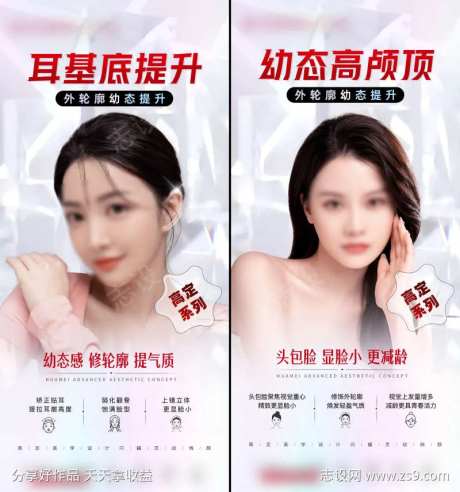 外轮廓幼态提升耳基底高颅顶头包脸微整-采灵感-https://www.cailinggan.com/