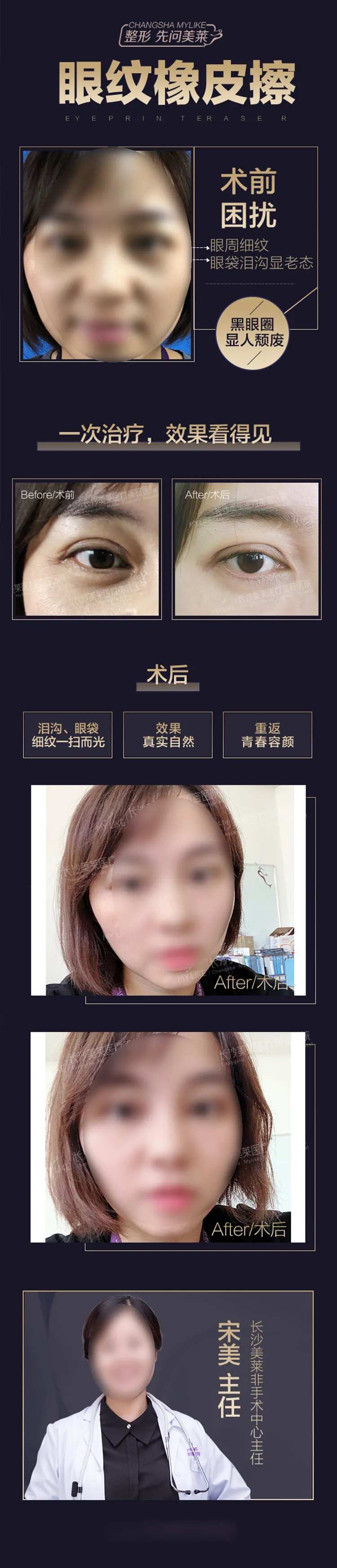 医美眼纹橡皮擦宣传海报-采灵感-cailinggan.com
