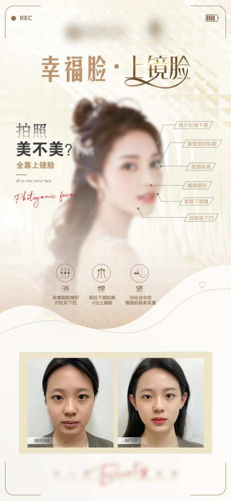 医美上镜脸面部对比图-采灵感-https://www.cailinggan.com/