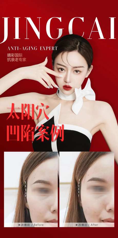 太阳穴  -采灵感-https://www.cailinggan.com/