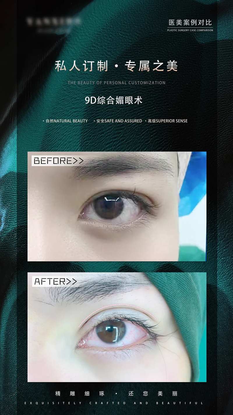 眼综合案例对比绿金海报-采灵感-cailinggan.com