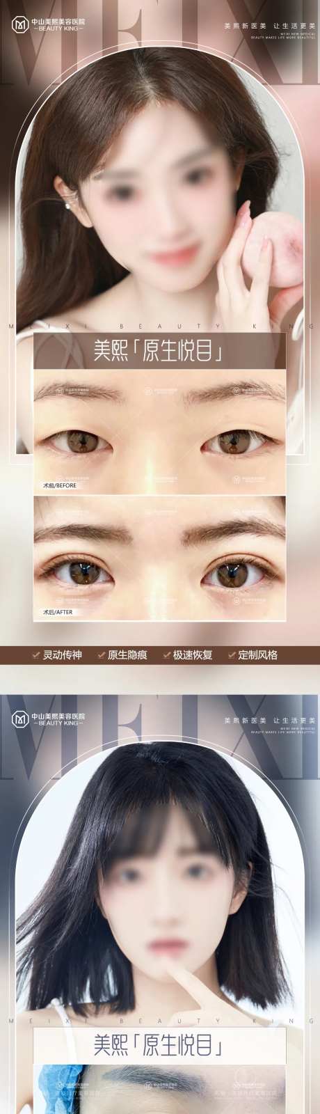 医美双眼皮案例海报-采灵感-https://www.cailinggan.com/
