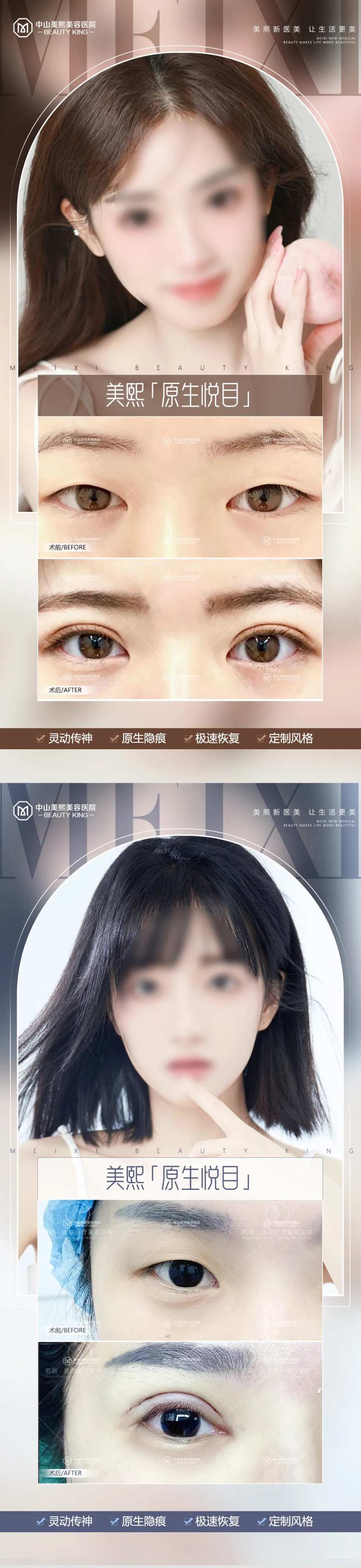 医美双眼皮案例海报-采灵感-cailinggan.com