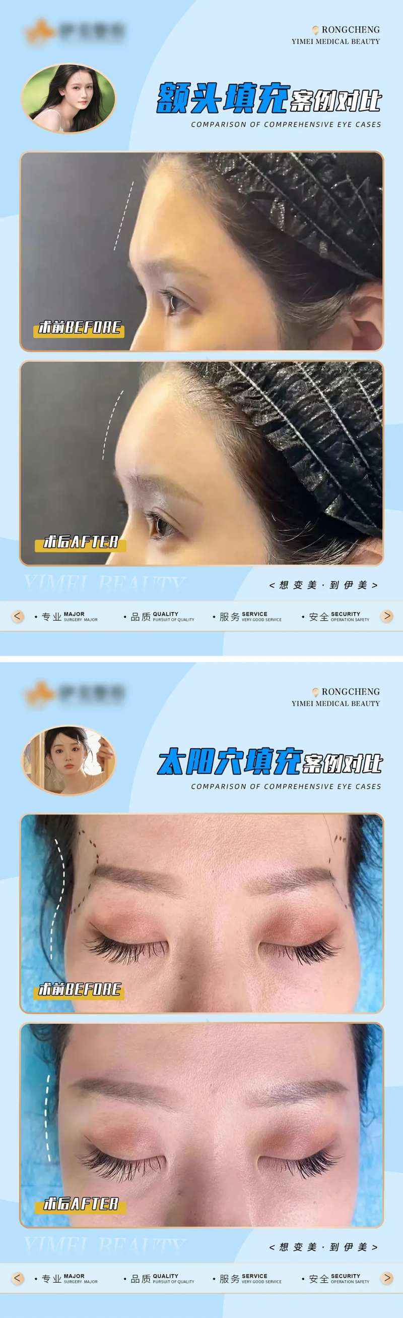 医美案例对比模版海报-采灵感-cailinggan.com