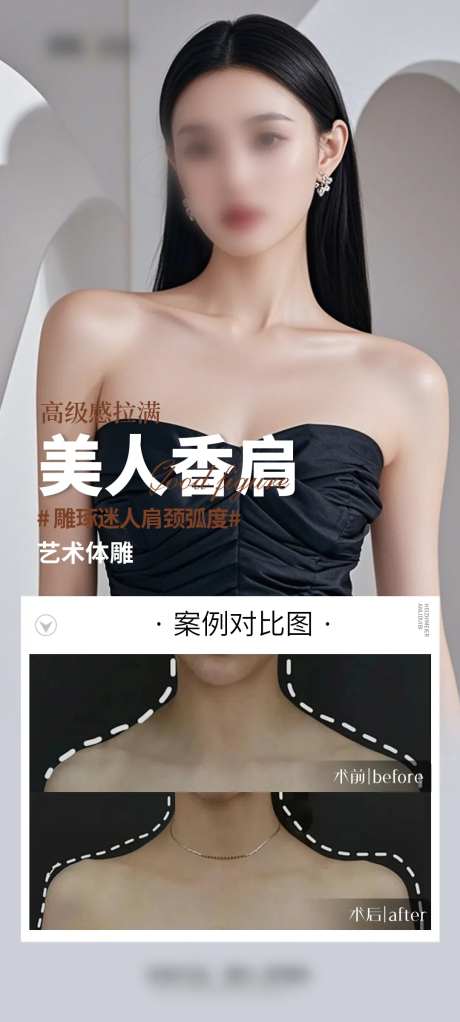 医美肩案例海报-采灵感-https://www.cailinggan.com/