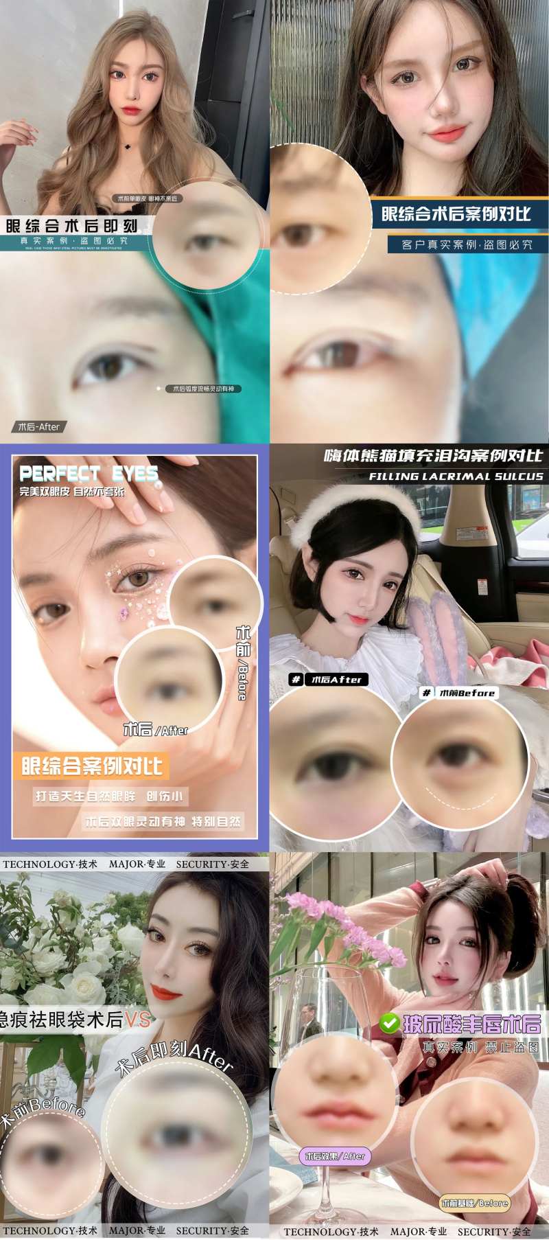 医美整形案例海波-采灵感-cailinggan.com