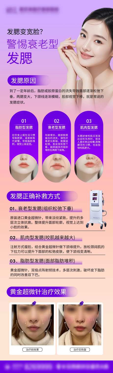 思嘉丽黄金超微针宣传-采灵感-https://www.cailinggan.com/