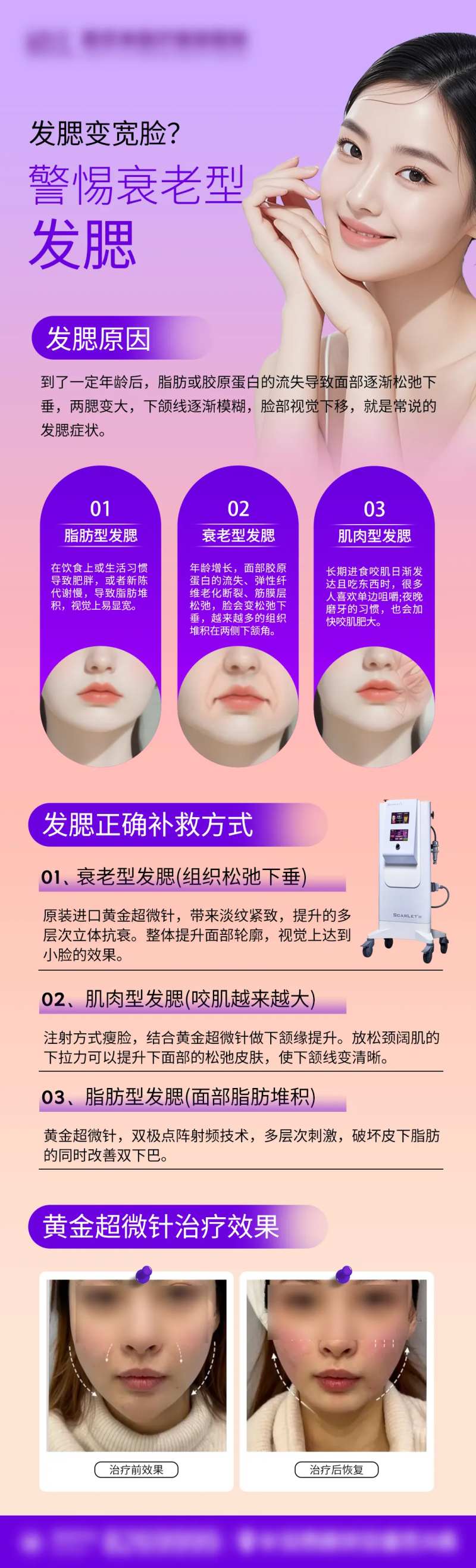 思嘉丽黄金超微针宣传-采灵感-cailinggan.com