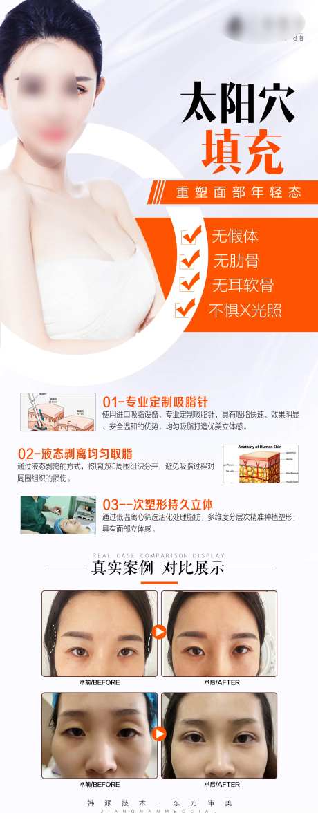 医美高端太阳穴填充海报长图-采灵感-https://www.cailinggan.com/