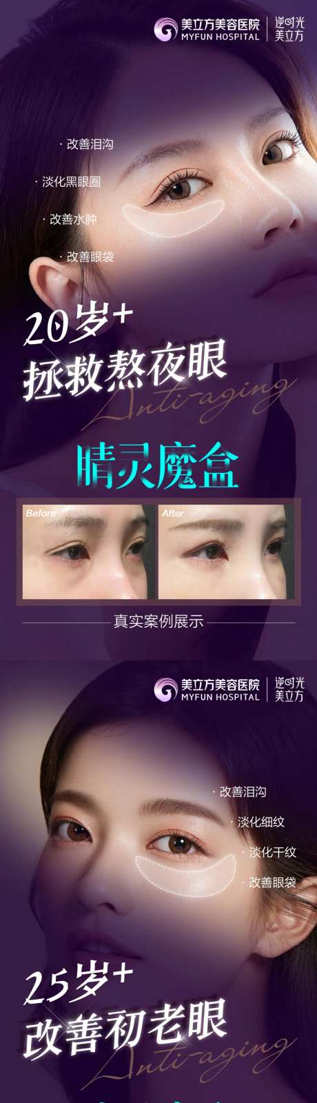 医美整形睛灵魔盒超龄眼案例对比美女-采灵感-https://www.cailinggan.com/