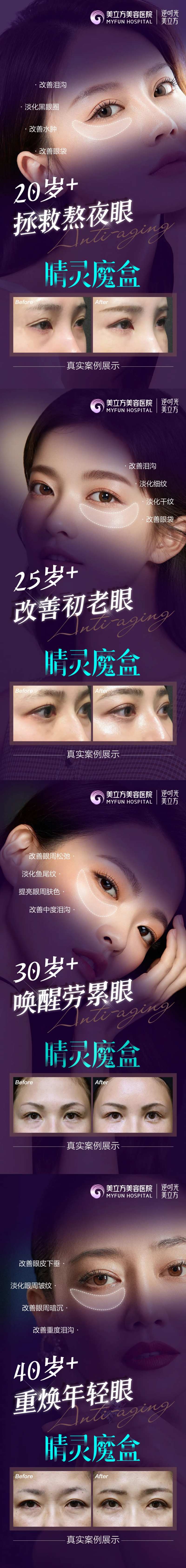 医美整形睛灵魔盒超龄眼案例对比美女-采灵感-cailinggan.com