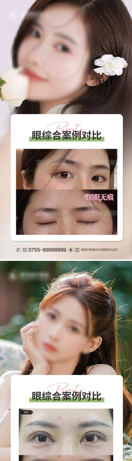 医美眼综合案例对比-采灵感-https://www.cailinggan.com/