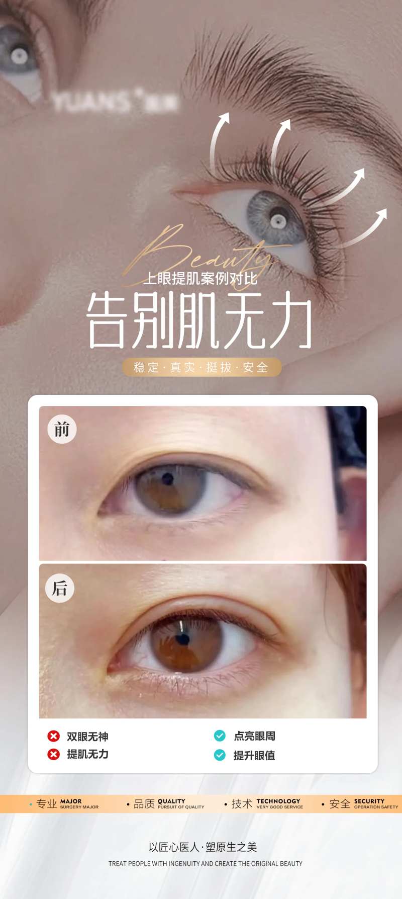医美眼周上眼提肌案例海报-采灵感-cailinggan.com