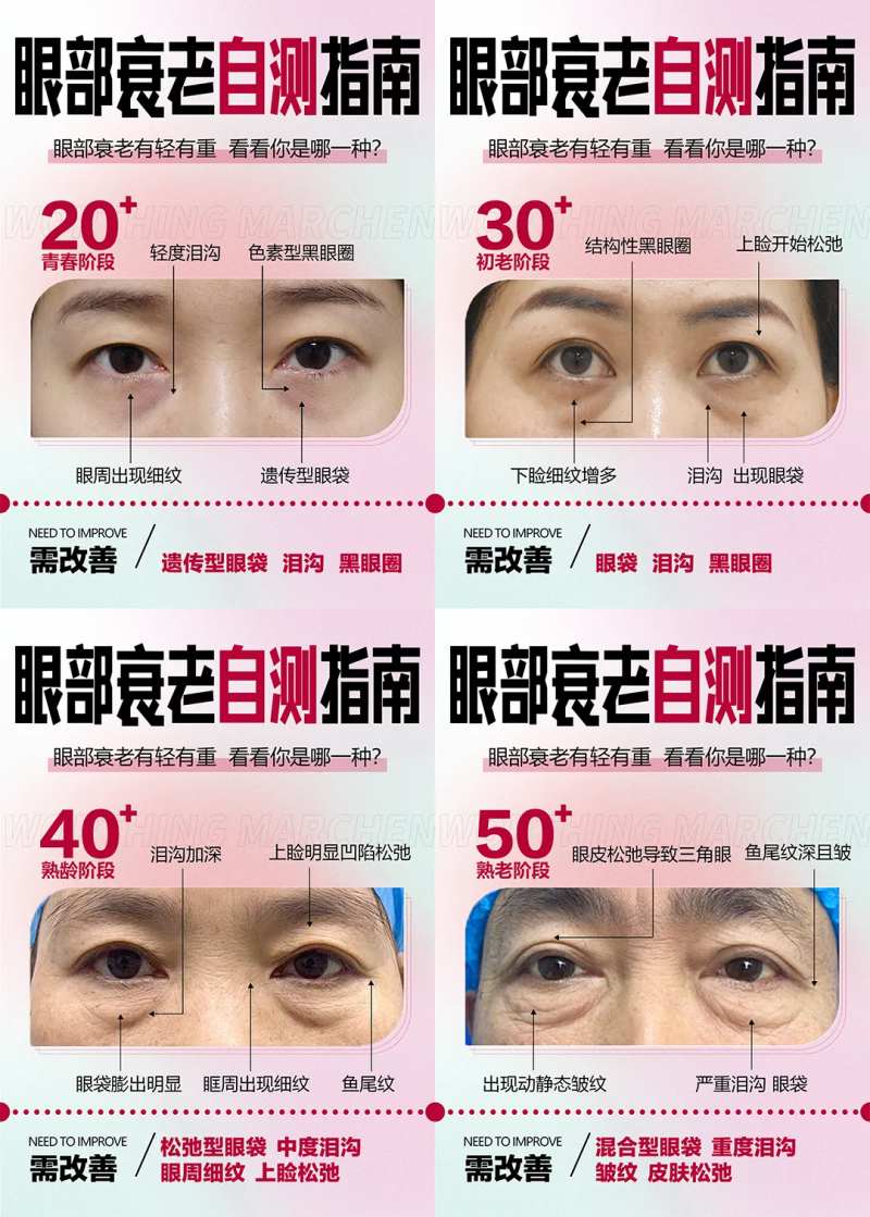 眼部抗衰自测科普海报-采灵感-cailinggan.com