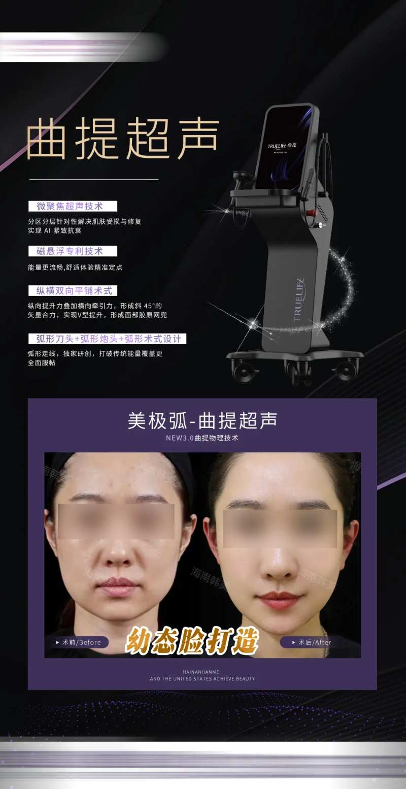 曲提超声案例-采灵感-cailinggan.com