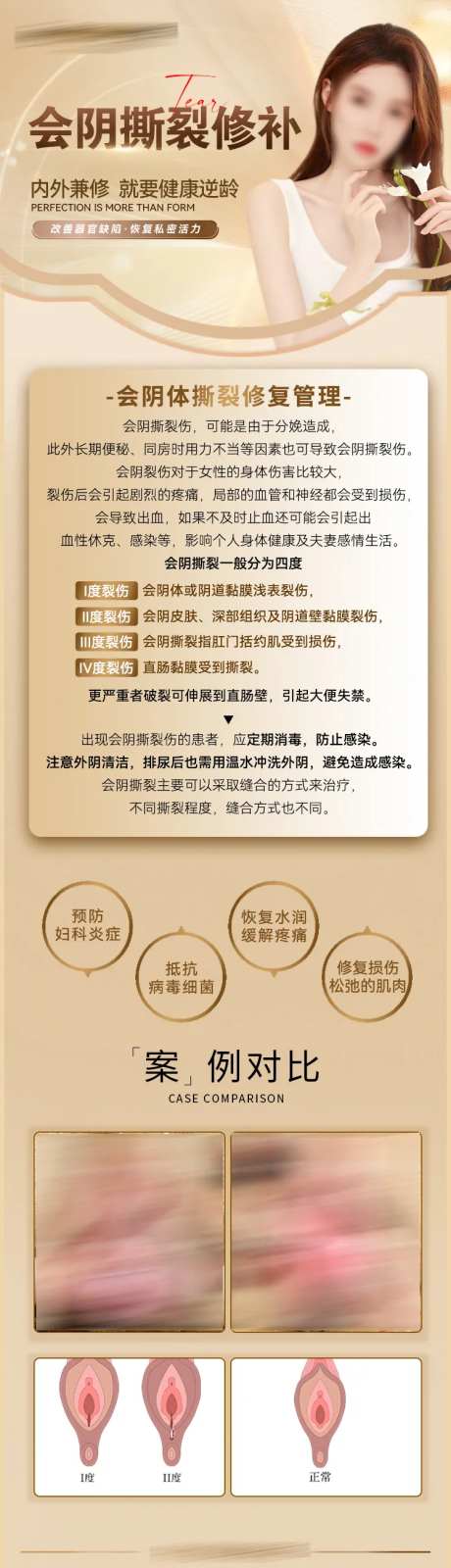 会阴撕裂案例长图-采灵感-https://www.cailinggan.com/
