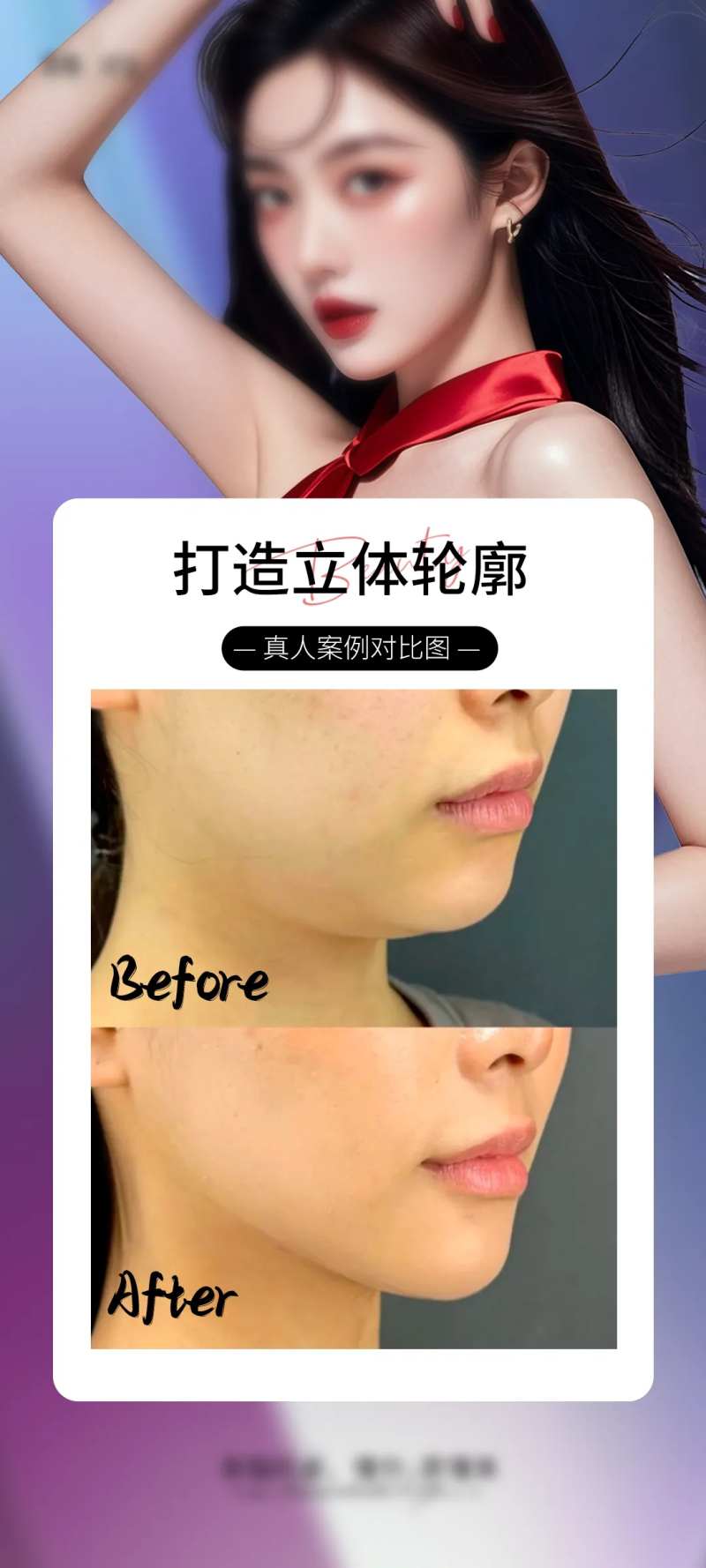 医美v脸海报-采灵感-cailinggan.com