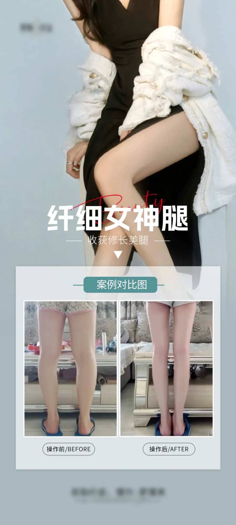 医美腿部吸脂案例海报-采灵感-cailinggan.com