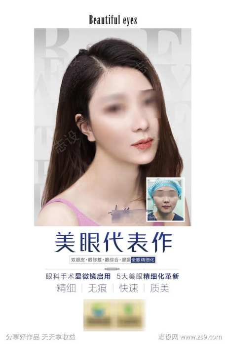 医美美眼代表作-采灵感-https://www.cailinggan.com/