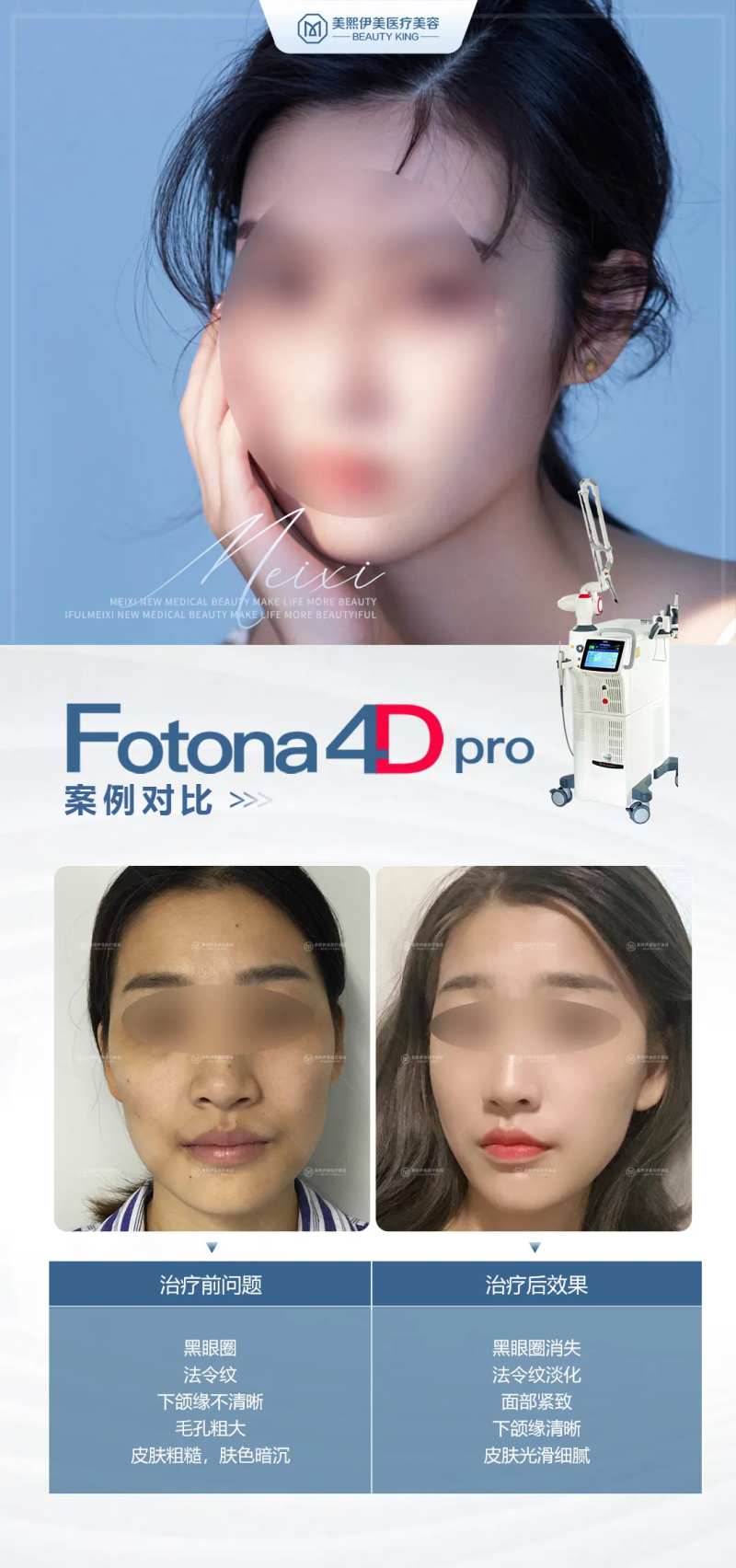 欧洲之星海报-采灵感-cailinggan.com