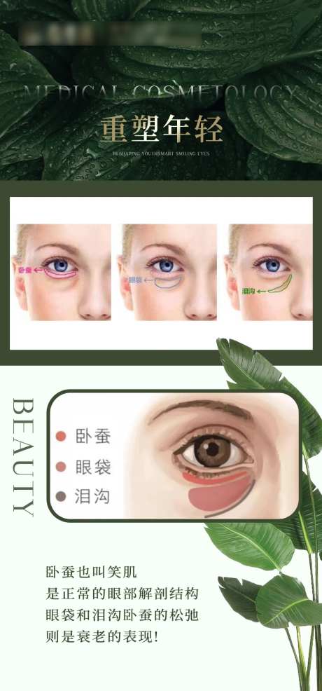 医美泪沟眼袋卧蚕重塑海报-采灵感-https://www.cailinggan.com/