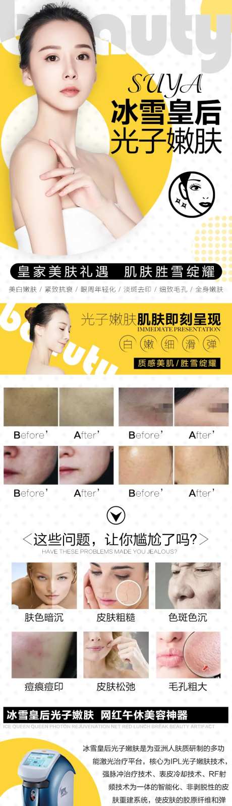 医美美容皇后光子新氧淘宝电商详情页-采灵感-https://www.cailinggan.com/