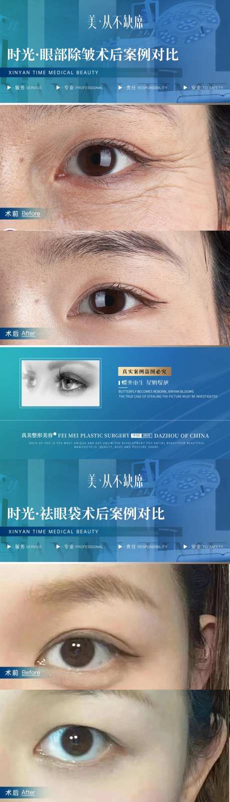 医美眼部除皱祛眼袋案例对比海报-采灵感-https://www.cailinggan.com/