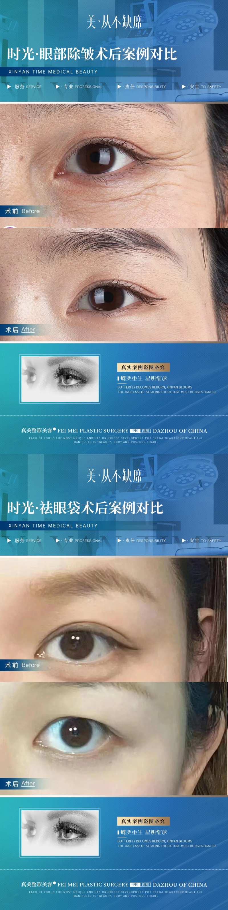 医美眼部除皱祛眼袋案例对比海报-采灵感-cailinggan.com