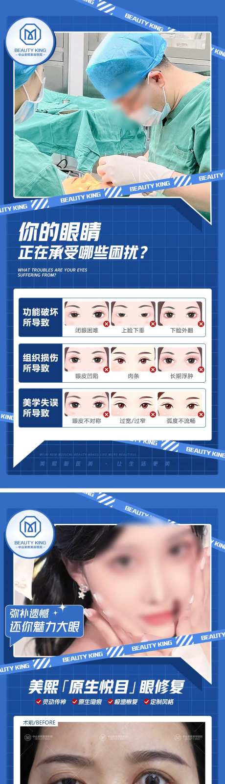 眼修复案例系列-采灵感-https://www.cailinggan.com/